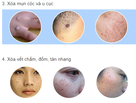 bút xóa tàn nhang